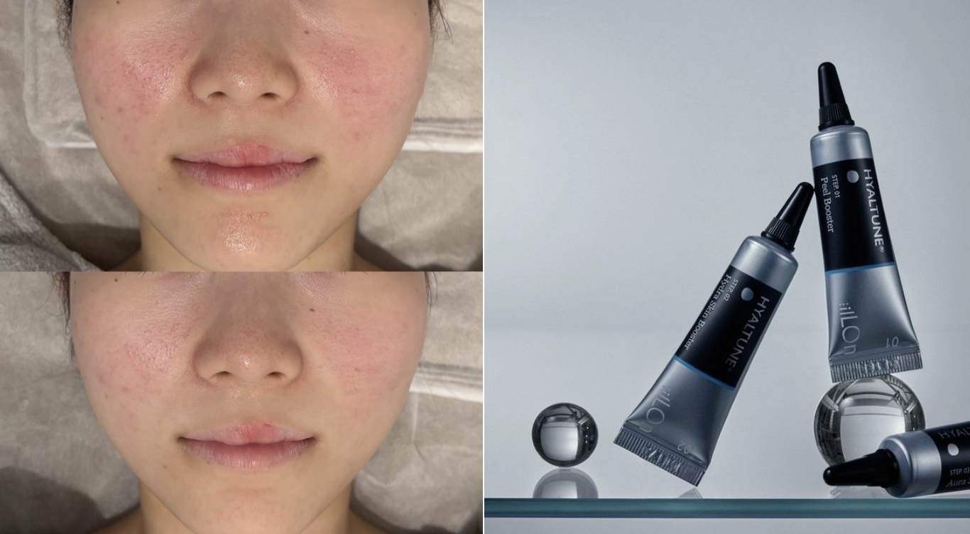 クリア&ウォーターチャージ