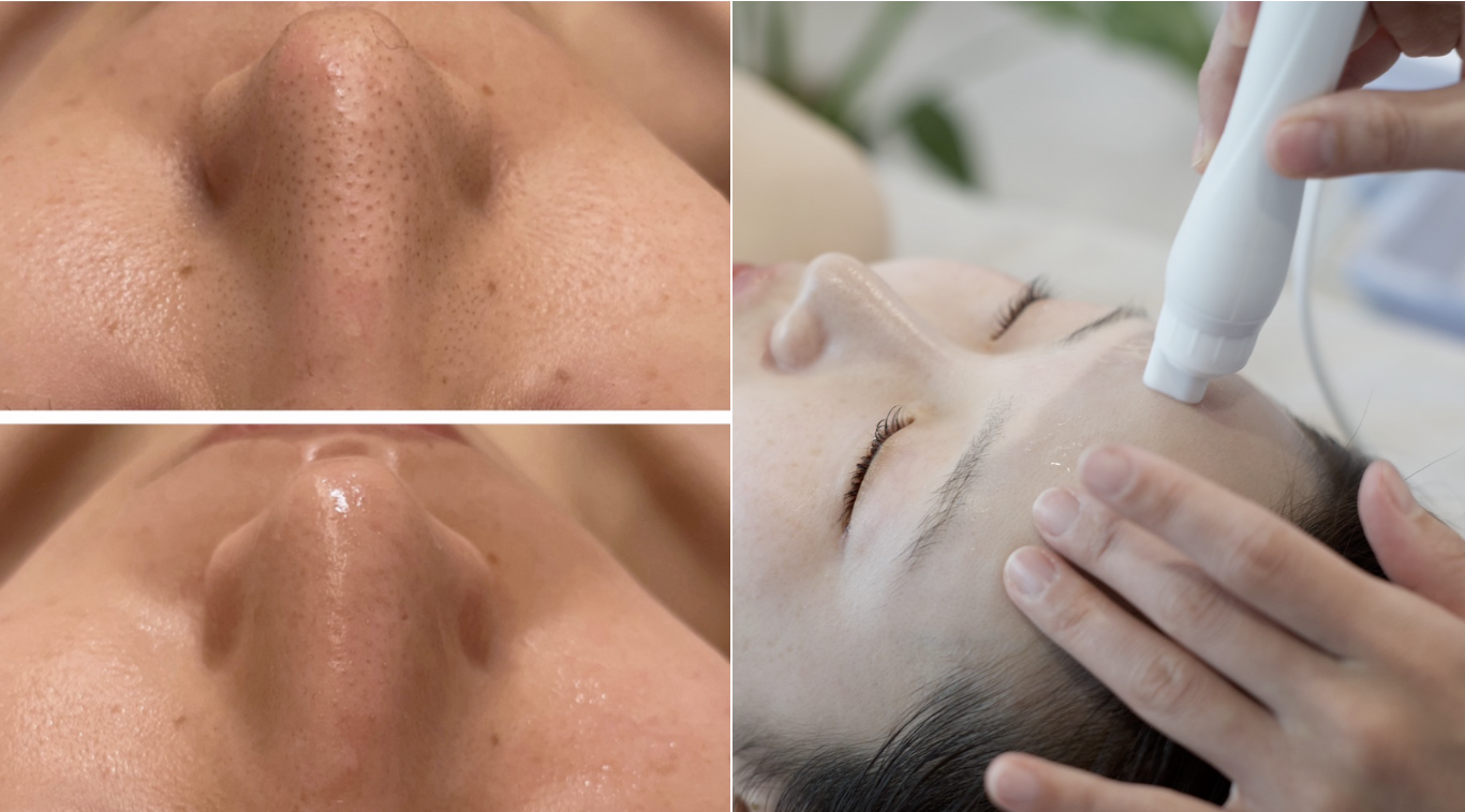 クリスタル毛穴クレンジング